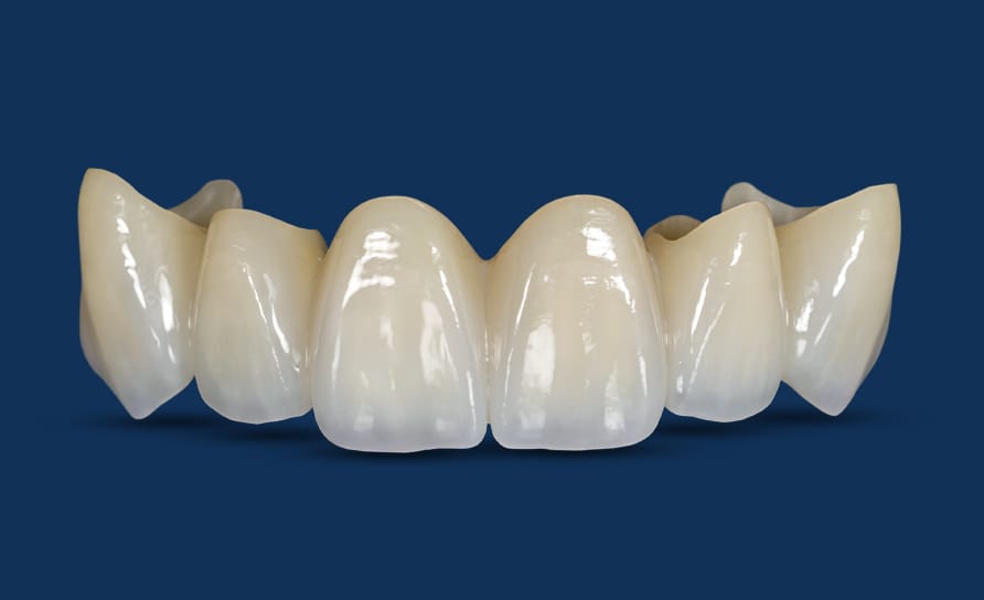 BruxZir® Zirconia Crowns and Bridges