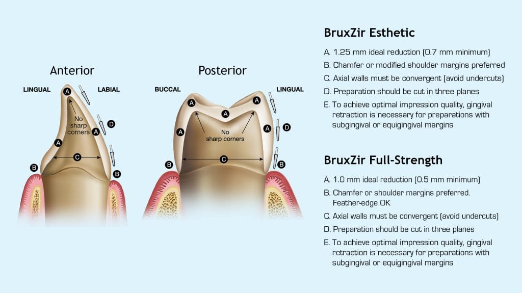 Bruxzir Crown Materials
