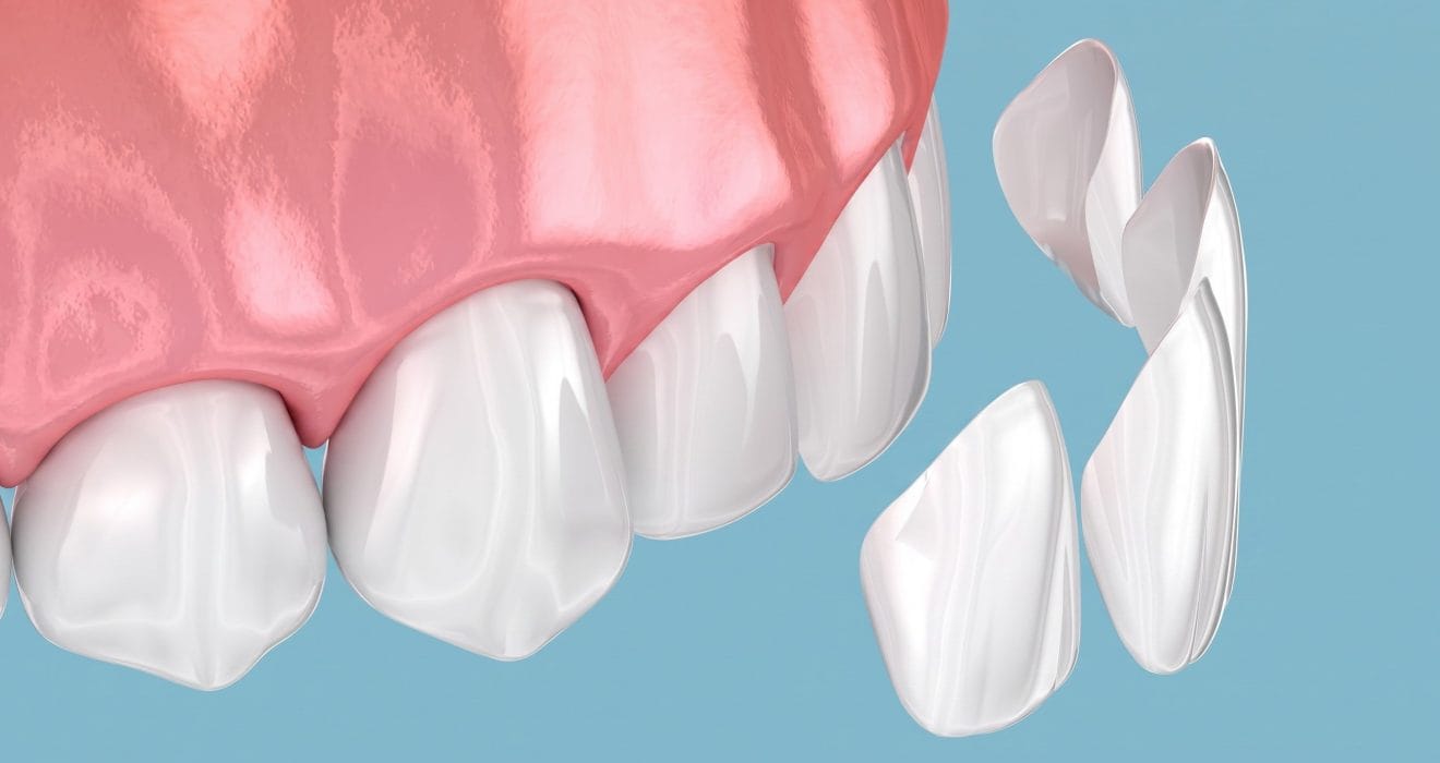 HT Zirconia Block