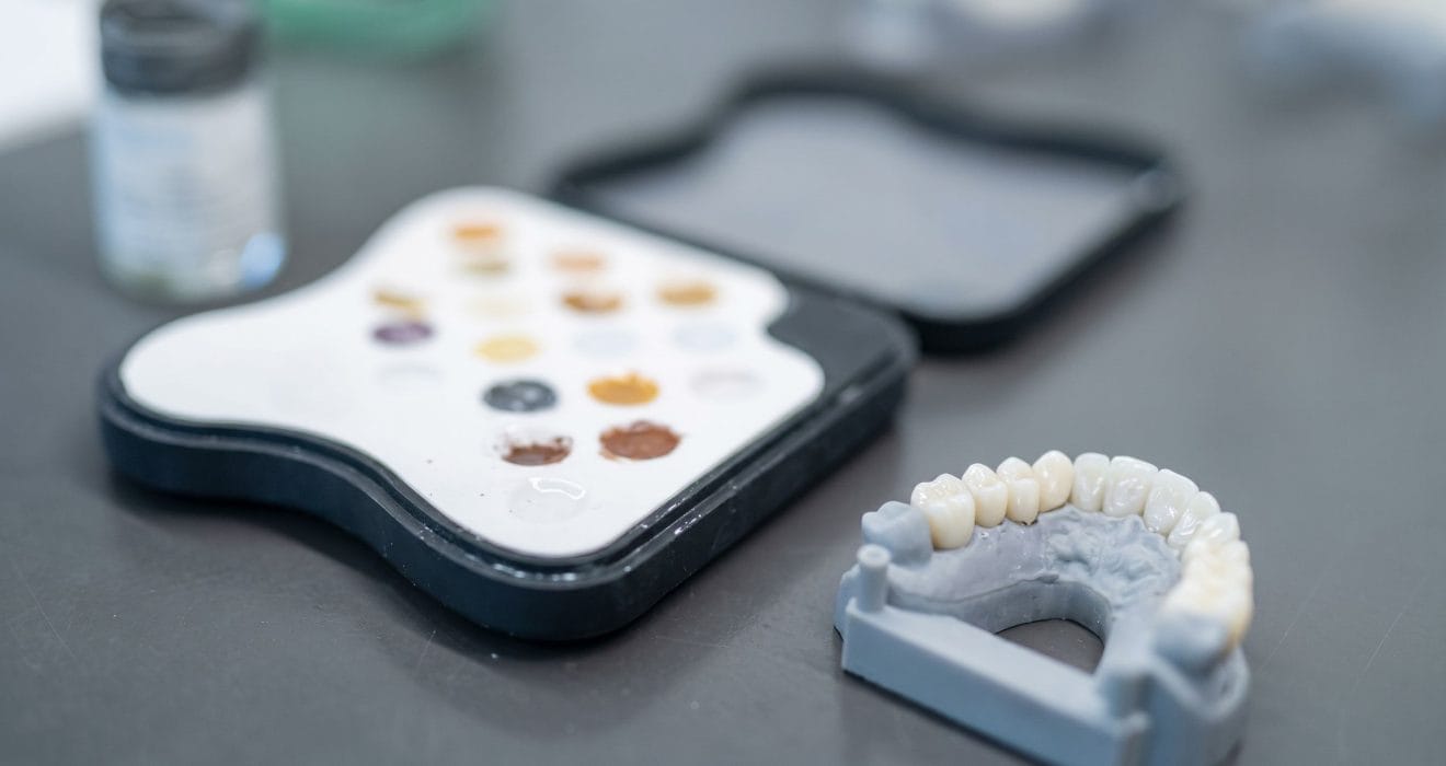 bruxzir anterior crown prep