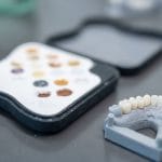 bruxzir anterior crown prep