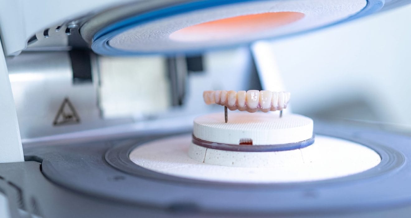 full contour translucent zirconia